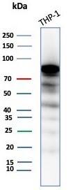 SATB2 Antibody (SATB2/8264R)