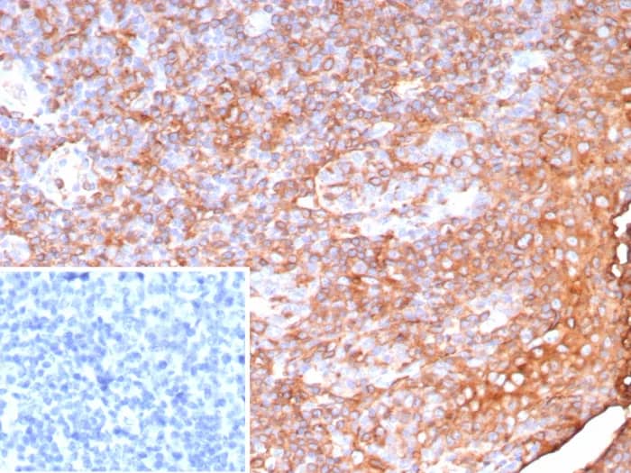 HLA DQ/DR/DP Antibody (HLA-Pan/9268R) Immunohistochemistry-Paraffin: HLA DQ/DR/DP Antibody (HLA-Pan/9268R) [NBP3-23800] -