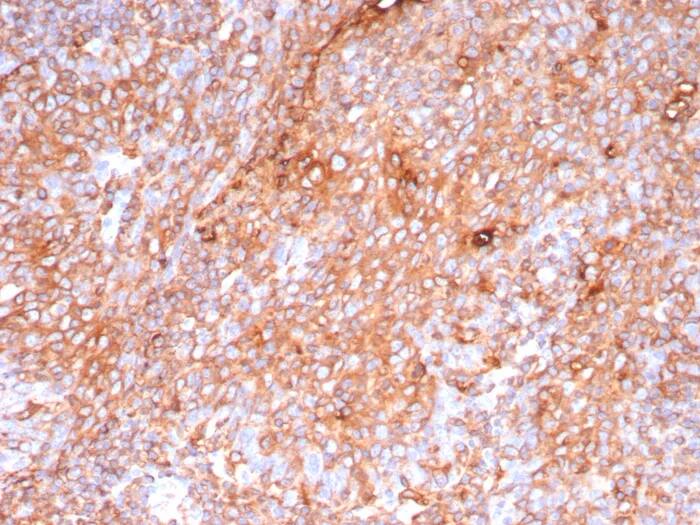 HLA DQ/DR/DP Antibody (HLA-Pan/9268R) Immunohistochemistry-Paraffin: HLA DQ/DR/DP Antibody (HLA-Pan/9268R) [NBP3-23800] -