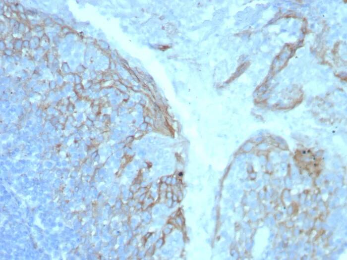 ICAM-1/CD54 Antibody (ICAM1/8247R) Immunohistochemistry-Paraffin: ICAM-1/CD54 Antibody (ICAM1/8247R) [NBP3-23801] -