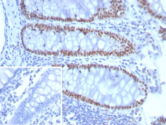 SATB2 Antibody (SATB2/8292R)