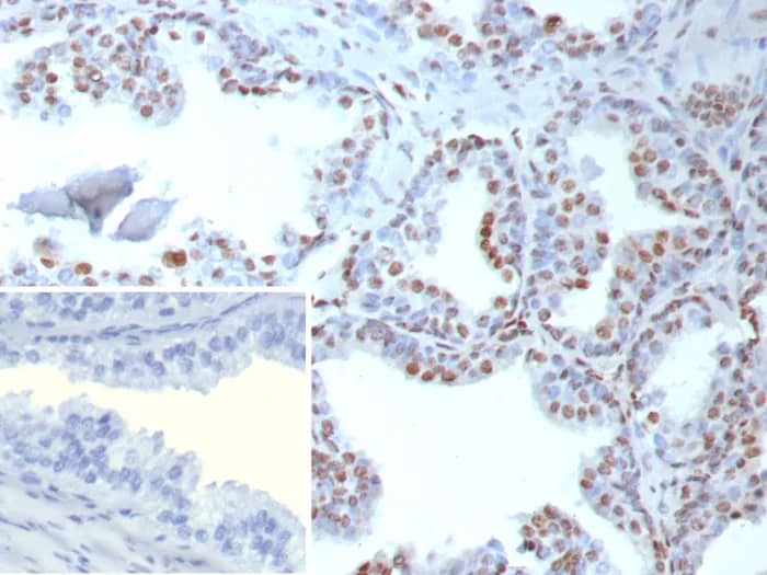 TDP-43/TARDBP Antibody (TARDP/9299R) Immunohistochemistry-Paraffin: TDP-43/TARDBP Antibody (TARDP/9299R) [NBP3-23805] -