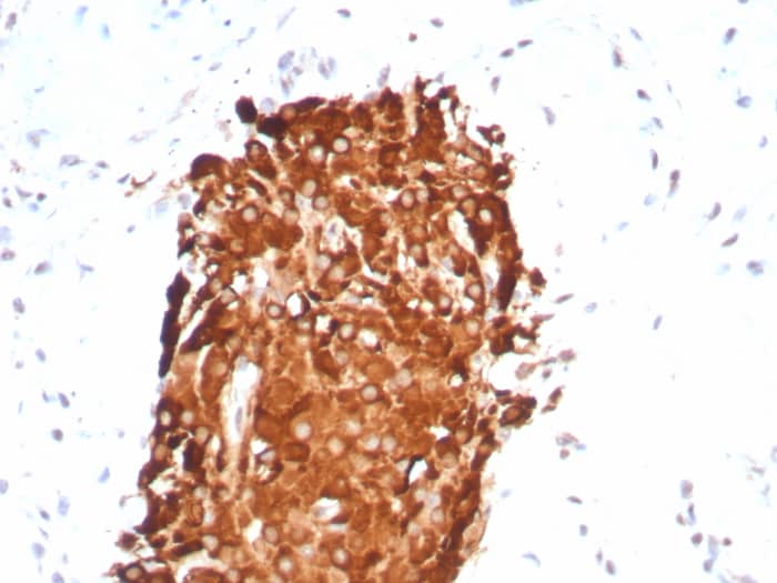 Inhibin alpha Antibody (INHA/8872R)