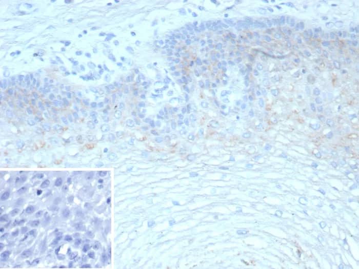 TRIM29 Antibody (TRIM29/9257R) Immunohistochemistry-Paraffin: TRIM29 Antibody (TRIM29/9257R) [NBP3-23809] -