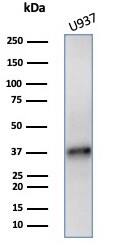 BAD-LAMP/LAMP5 Antibody (LAMP5/7642)