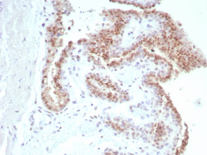 Androgen R/NR3C4 Antibody (rDHTR/8818)