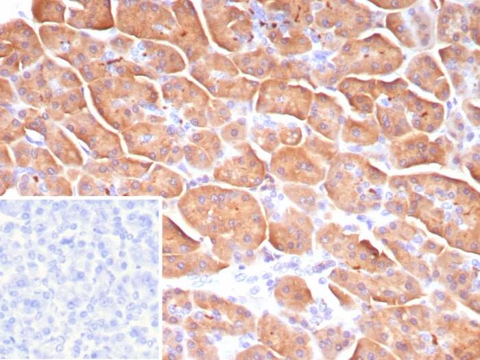 CLPS Antibody (CLPS/9021) Immunohistochemistry-Paraffin: CLPS Antibody (CLPS/9021) [NBP3-23815] -