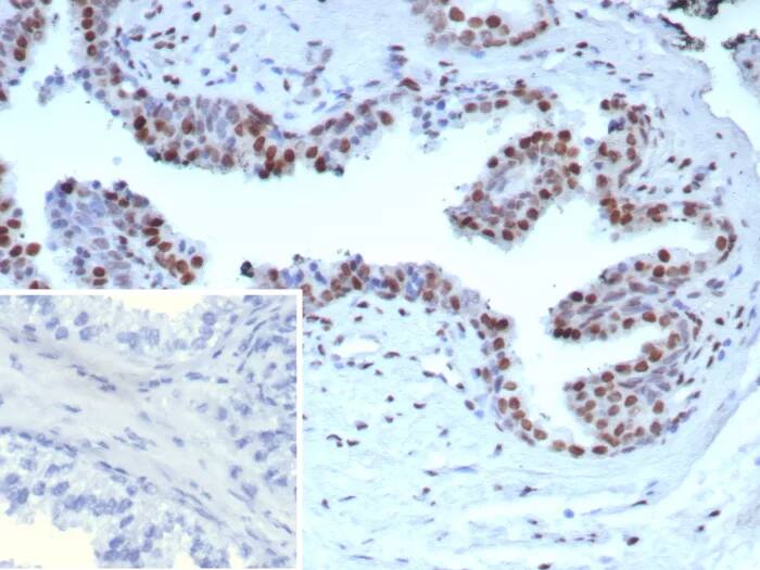 Androgen R/NR3C4 Antibody (DHTR/9119R) Immunohistochemistry-Paraffin: Androgen R/NR3C4 Antibody (DHTR/9119R) [NBP3-23817] -