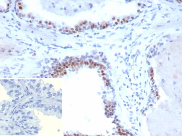 Androgen Receptor V7 Antibody (DHTR.V7/9394R) Immunohistochemistry-Paraffin: Androgen Receptor V7 Antibody (DHTR.V7/9394R) [NBP3-23821] -