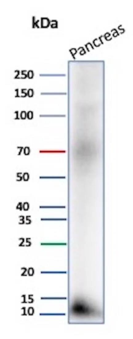 CLPS Antibody (CLPS/9027) Western Blot: CLPS Antibody (CLPS/9027) [NBP3-23824] -