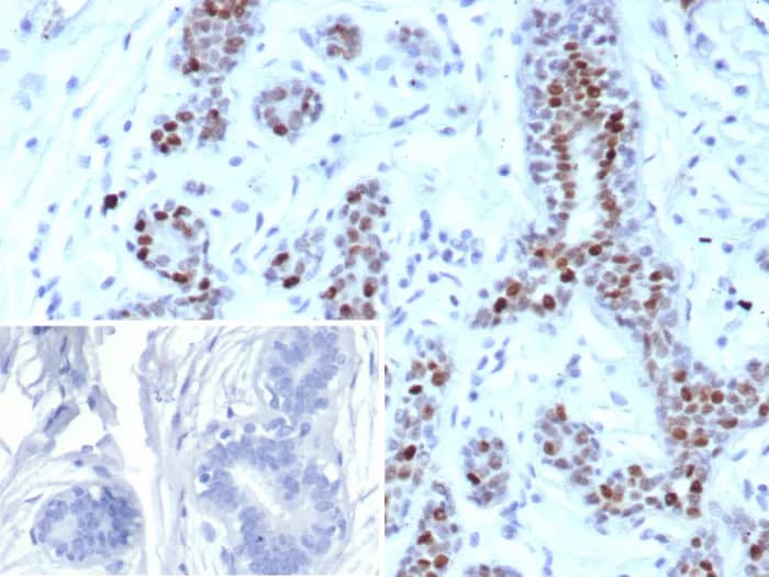 GATA-3 Antibody (rGATA3/9133) Immunohistochemistry-Paraffin: GATA-3 Antibody (rGATA3/9133) [NBP3-23825] -