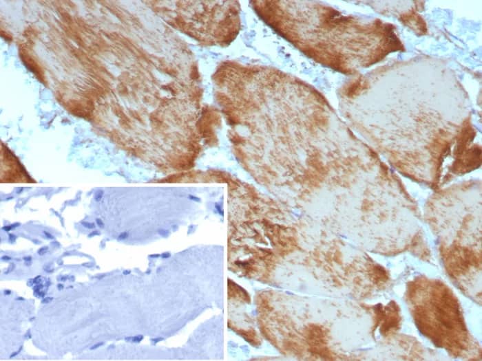 Actin (Muscle Specific) Antibody (ACTA1/9105R) Immunohistochemistry-Paraffin: Actin (Muscle Specific) Antibody (ACTA1/9105R) [NBP3-23827] -