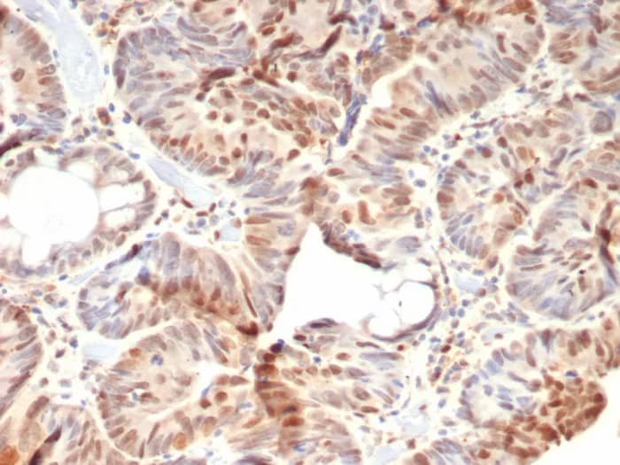 RB1 Antibody (rRB1/8060) Immunohistochemistry-Paraffin: RB1 Antibody (rRB1/8060) [NBP3-23828] -