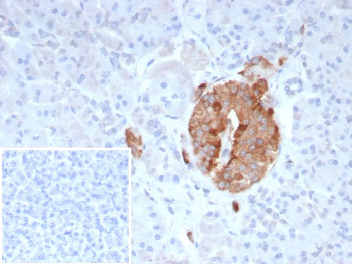 Collagen IV Antibody (COL4/9395R)