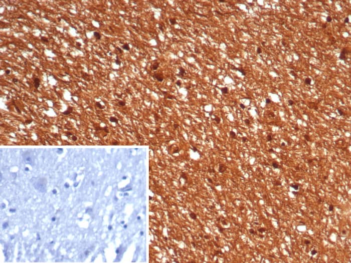 GBX2 Antibody (GBX2/7235)