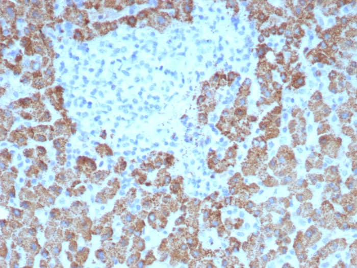 CPS1 Antibody (CPS1/8417)