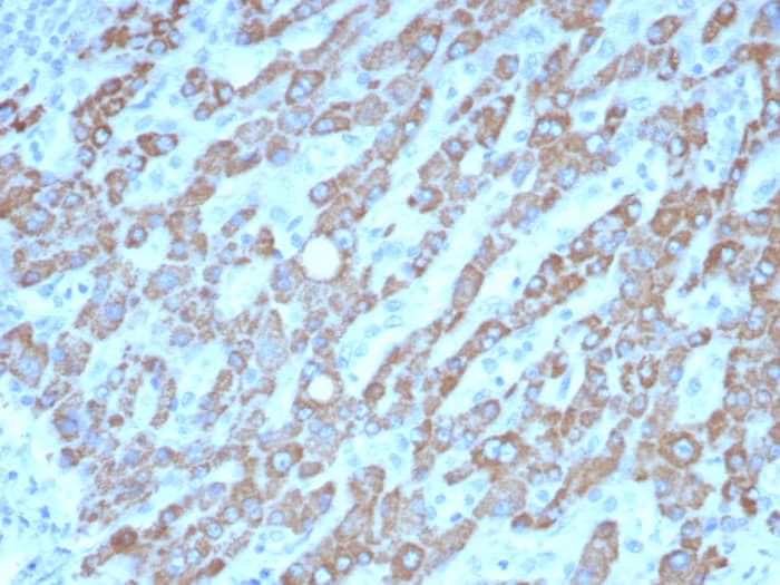 CPS1 Antibody (CPS1/8420)