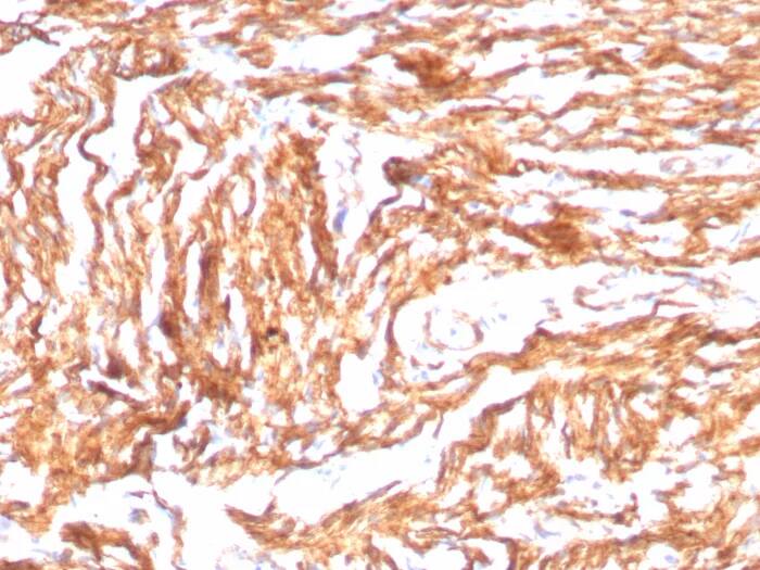 N-Cadherin Antibody (CDH2/8998R) Immunohistochemistry-Paraffin: N-Cadherin Antibody (CDH2/8998R) [NBP3-23846] -