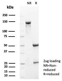 S100A5 Antibody (S100A5/7474)