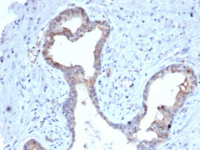 S100A5 Antibody (S100A5/7475)