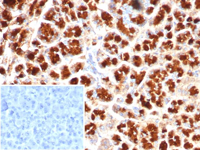 GIRK2 Antibody (KCNJ6/7558)