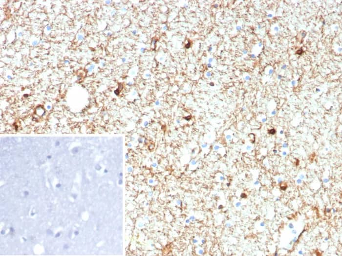 GFAP Antibody (rGFAP/9150) Immunohistochemistry-Paraffin: GFAP Antibody (rGFAP/9150) [NBP3-23853] -