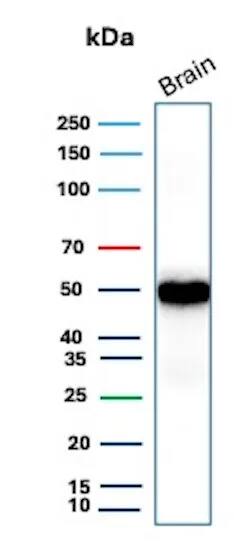 GFAP Antibody (rGFAP/9150) Western Blot: GFAP Antibody (rGFAP/9150) [NBP3-23853] -