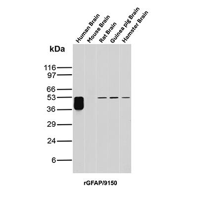 GFAP Antibody (rGFAP/9150) Western Blot: GFAP Antibody (rGFAP/9150) [NBP3-23853] -