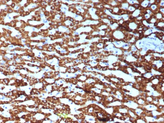 CPS1 Antibody (CPS1/9151R) Immunohistochemistry-Paraffin: CPS1 Antibody (CPS1/9151R) [NBP3-23855] -