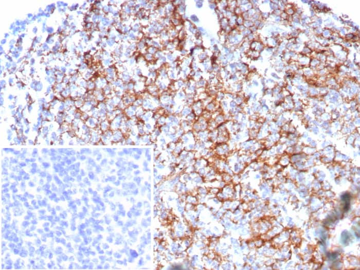 CD35 Antibody (rCR1/8596)