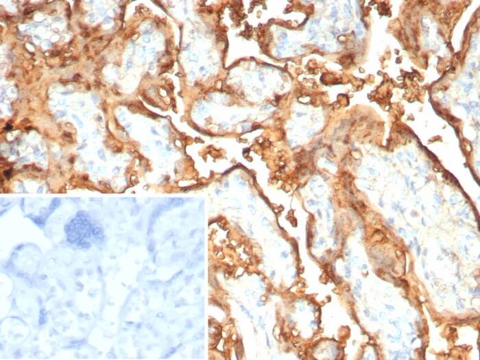 S100P Antibody (rS100P/9254) Immunohistochemistry-Paraffin: S100P Antibody (rS100P/9254) [NBP3-23857] -