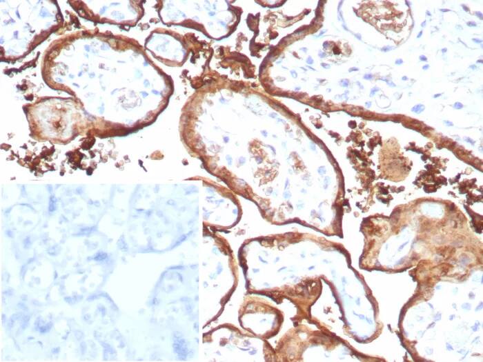 S100P Antibody (S100P/9135R) Immunohistochemistry-Paraffin: S100P Antibody (S100P/9135R) [NBP3-23858] -