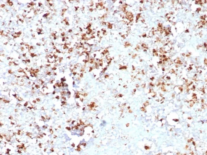 Myeloperoxidase/MPO Antibody (MPO/8631R) Immunohistochemistry-Paraffin: Myeloperoxidase/MPO Antibody (MPO/8631R) [NBP3-23859] -