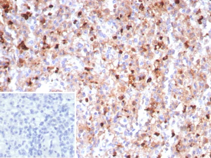 Myeloperoxidase/MPO Antibody (MPO/8290R) Immunohistochemistry-Paraffin: Myeloperoxidase/MPO Antibody (MPO/8290R) [NBP3-23861] -