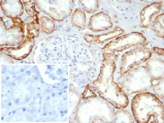 Cadherin-16 Antibody (rCDH16/7343) Immunohistochemistry-Paraffin: Cadherin-16 Antibody (rCDH16/7343) [NBP3-23866] -