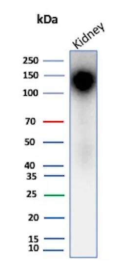 Cadherin-16 Antibody (rCDH16/7343) Western Blot: Cadherin-16 Antibody (rCDH16/7343) [NBP3-23866] -