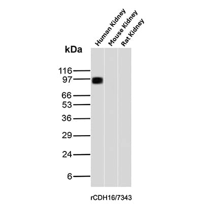 Cadherin-16 Antibody (rCDH16/7343) Western Blot: Cadherin-16 Antibody (rCDH16/7343) [NBP3-23866] -