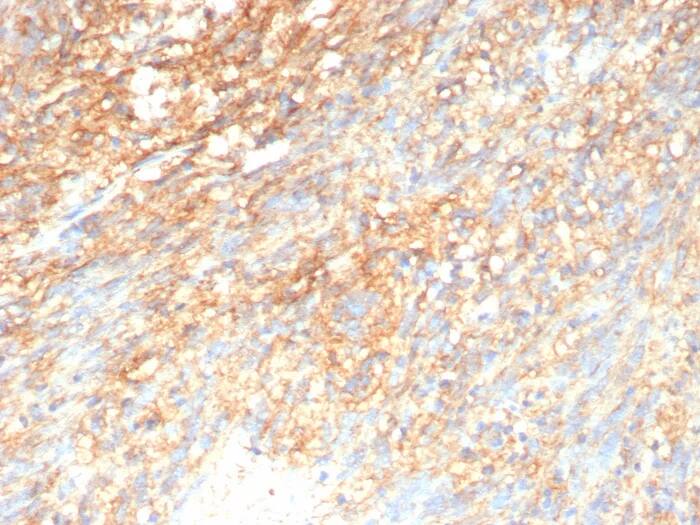 CD117/c-kit Antibody (rC117/9253) Immunohistochemistry-Paraffin: CD117/c-kit Antibody (rC117/9253) [NBP3-23868] -