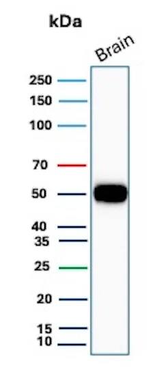 GFAP Antibody (GFAP/8615R) Western Blot: GFAP Antibody (GFAP/8615R) [NBP3-23869] -