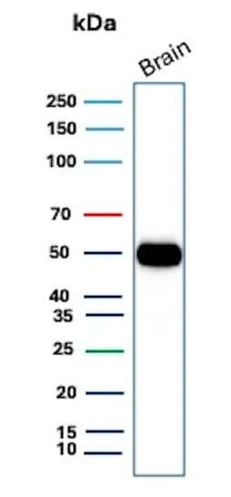 GFAP Antibody (GFAP/8616R) Western Blot: GFAP Antibody (GFAP/8616R) [NBP3-23870] -