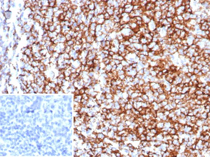 CD35 Antibody (rCR1/8597)