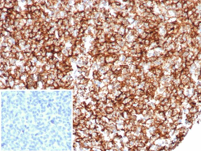 CD35 Antibody (rCR1/8599)