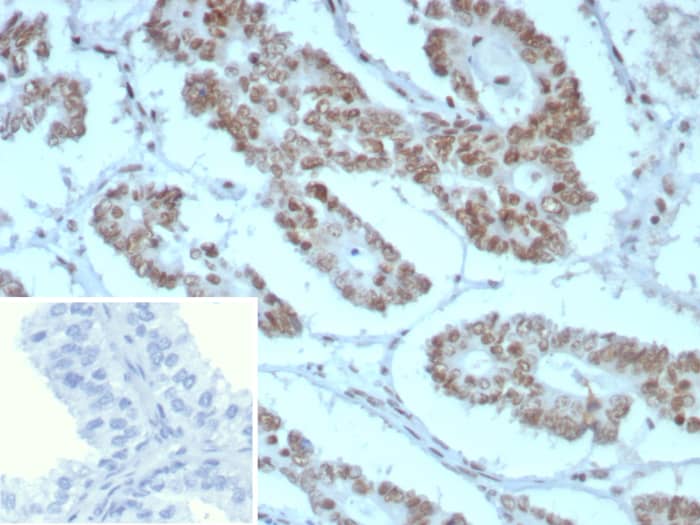 SNF5 Antibody (rINI1/8850)