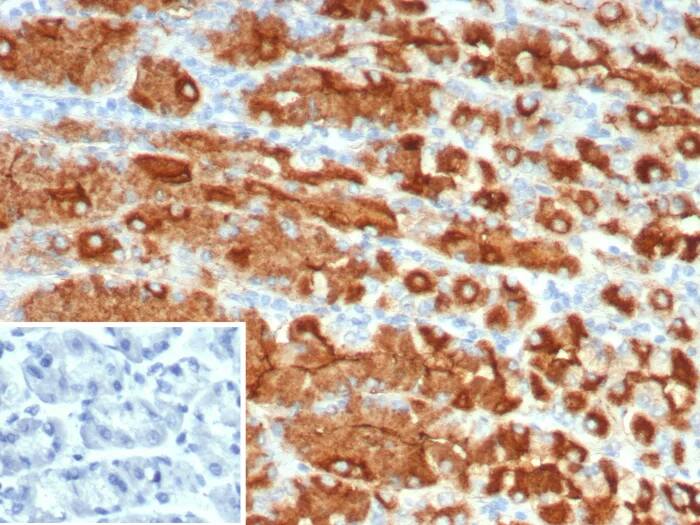 MUC1 Antibody (r115D8) Immunohistochemistry-Paraffin: MUC1 Antibody (r115D8) [NBP3-23878] -