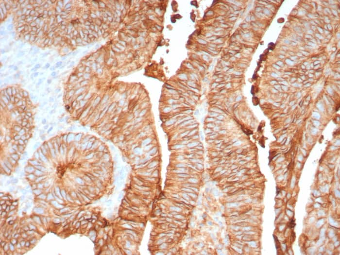 Cadherin-17 Antibody (CDH17/8158R])