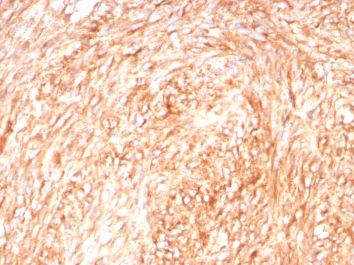 CD117/c-kit Antibody (C117/8879R)