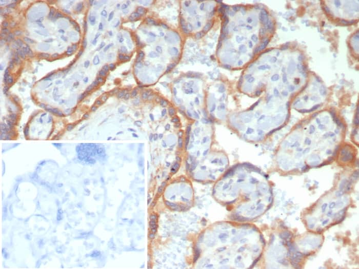 Glypican 3 Antibody (GPC3/7991R)