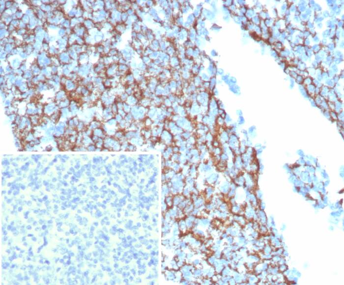 CD35 Antibody (CR1/8244R)