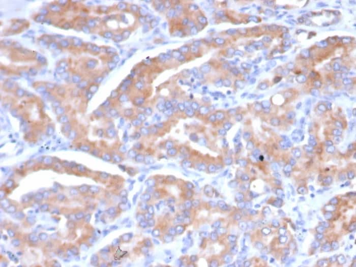 CHID1 Antibody (CHID1/6368) Immunohistochemistry-Paraffin: CHID1 Antibody (CHID1/6368) [NBP3-23888] -