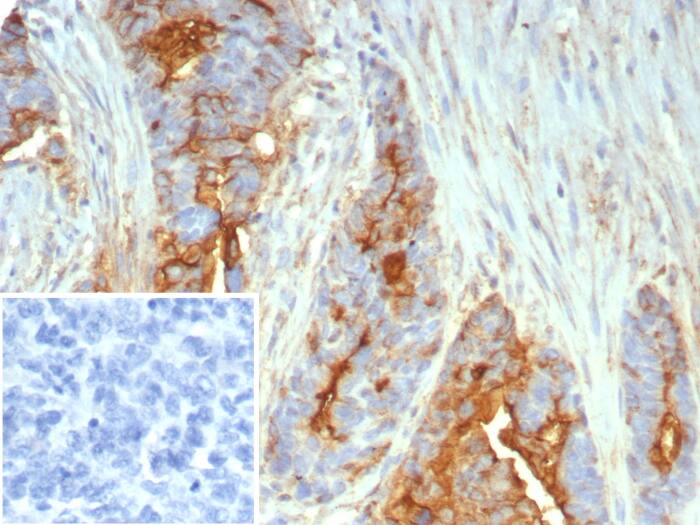 MUC1 Antibody (MUC1/7797R)